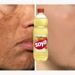 Óleo De Soja Para Manchas No Rosto